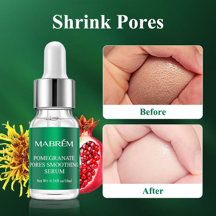 MABREM Pore Shrinking Serum Essence Pores Treatment Moisturizing Relieve Dryness Oil-Control Firming Repairing Smooth Skin Care